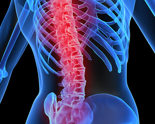 The back is easily injured x-ray image highlighting the spine which is a common area for injury
