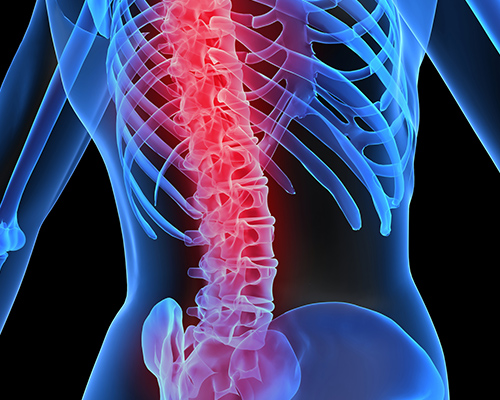 x-ray image highlighting the spine which is a common area for injury